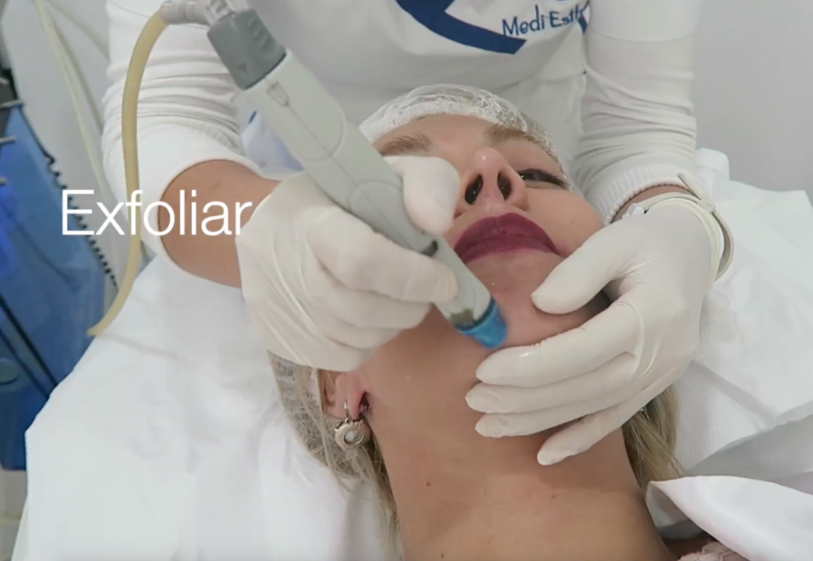 Captura de pantalla 2018-02-08 a las 20.07.06 hydrafacial Hydrafacial el facial mas completo del momento Captura de pantalla 2018 02 08 a las 20